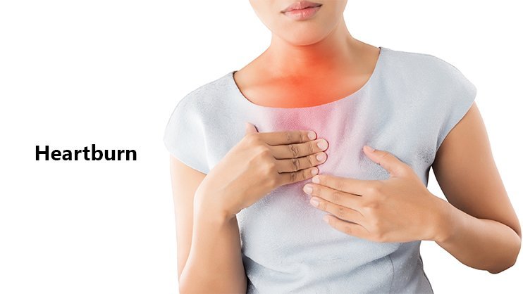 Prominent Causes and Few Effective Remedies of Heartburn