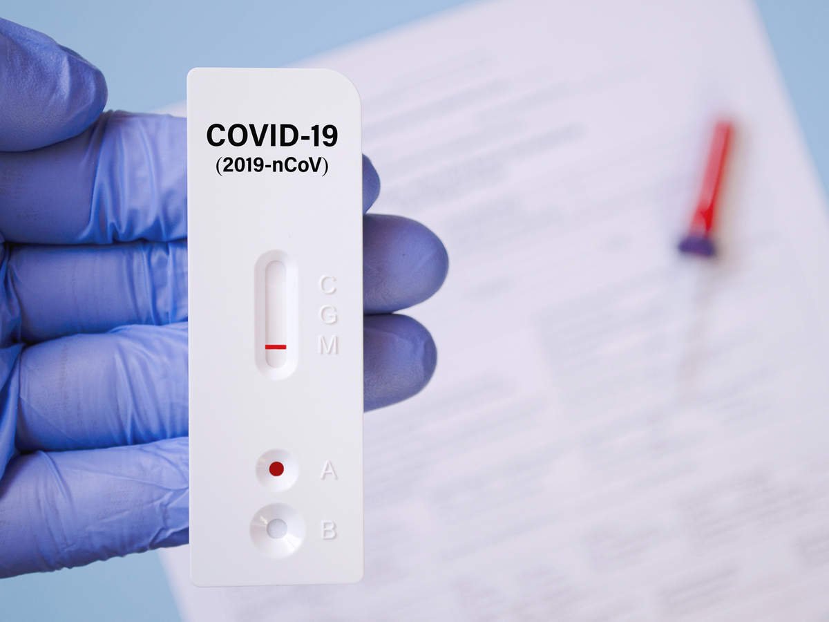 Why conduct a COVID RT-PCR Test?