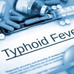 Typhoid fever