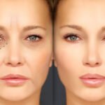Plastic Surgery