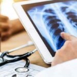 mesothelioma survival rates