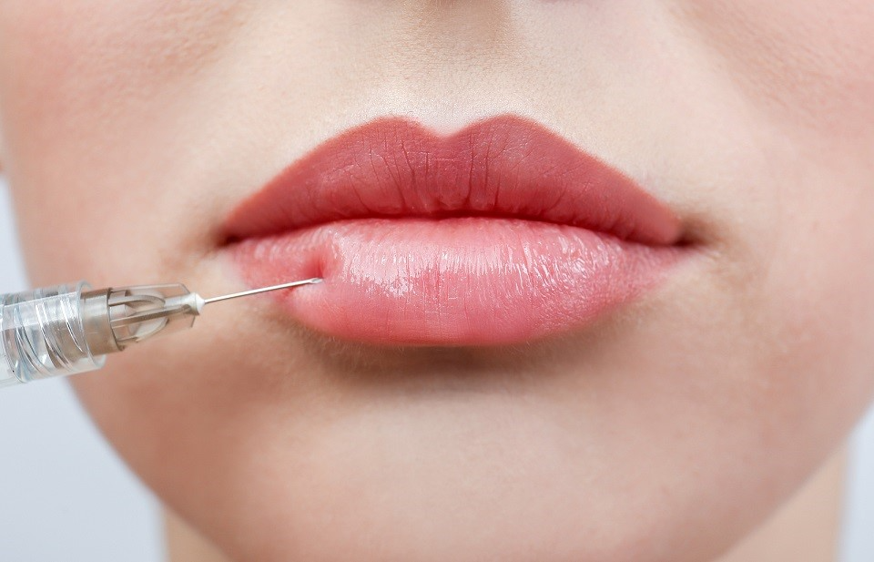 5 Common Myths About Dermal Fillers Debunked