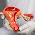 Fallopian Tube Blockage