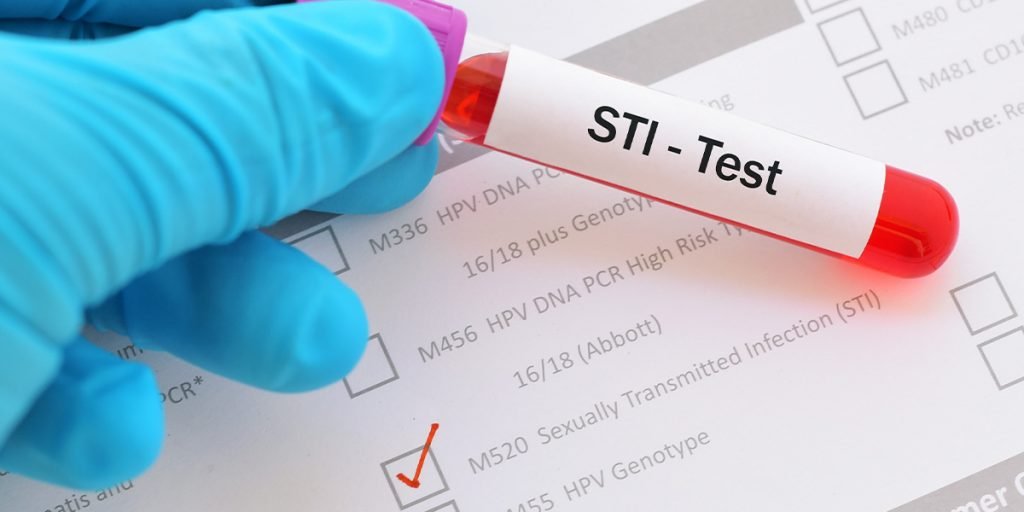 How Do You Get Tested For STDs